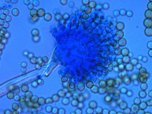 Schimmelpilze unter dem Elektronenmikroskop © aus Frank Frössel "Schimmelpilze in Wohnungen" (Baulino Verlag)